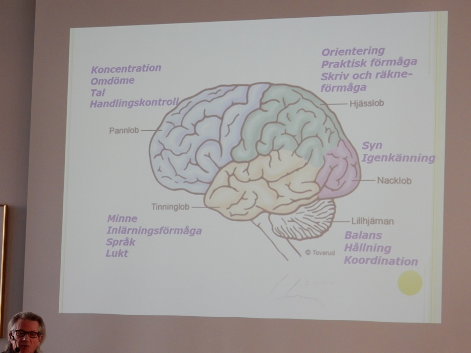 Schematisk bild på hjärnan och dess funktioner